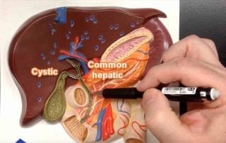 Cholnagiocarcinoma Australia - ile Ducts made easy -An easy to follow video on the relationship between the bile ducts, liver, stomach, pancreas, duodenum and more such as Ampular, Hepatic Artery . . .